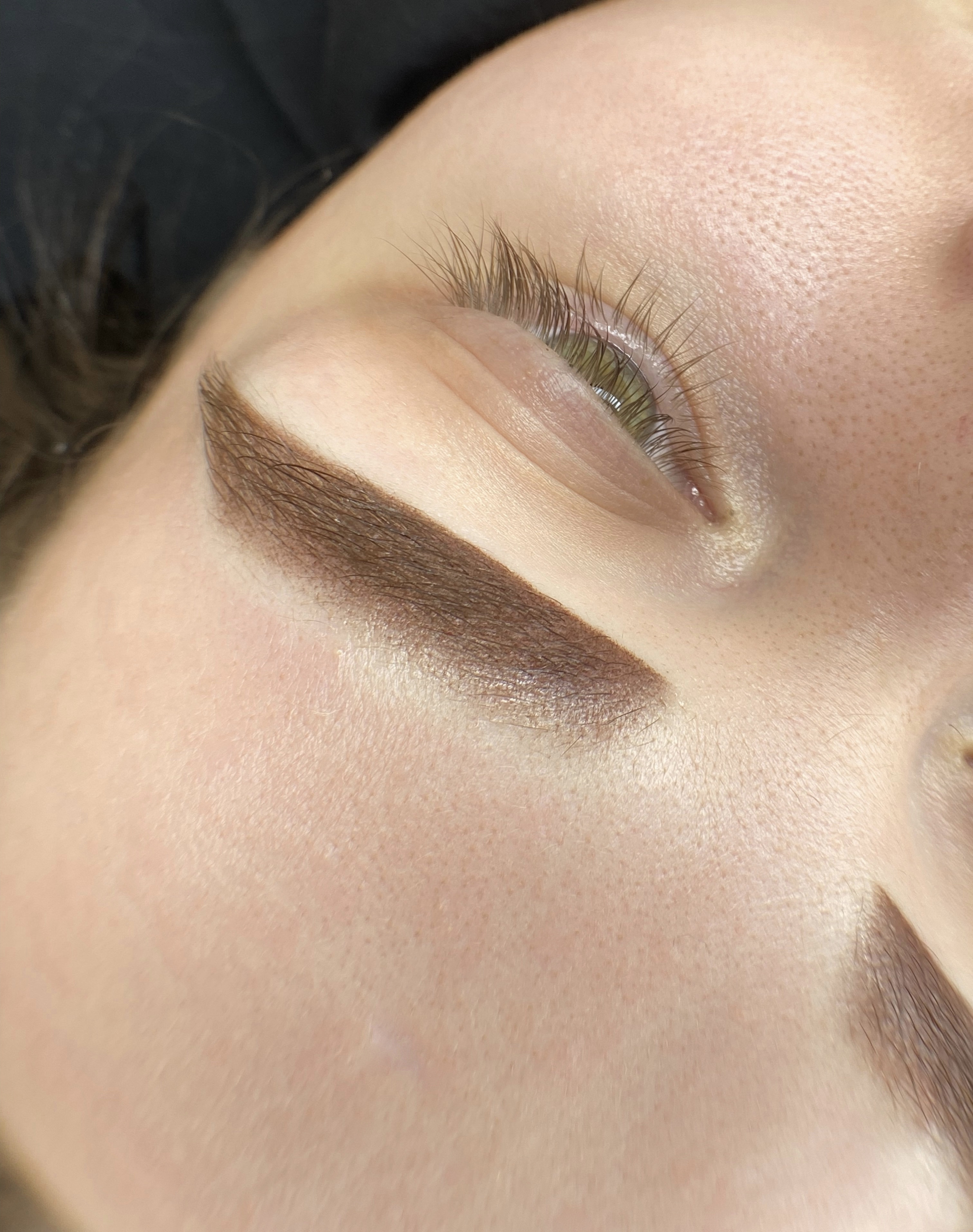 Фото услуги