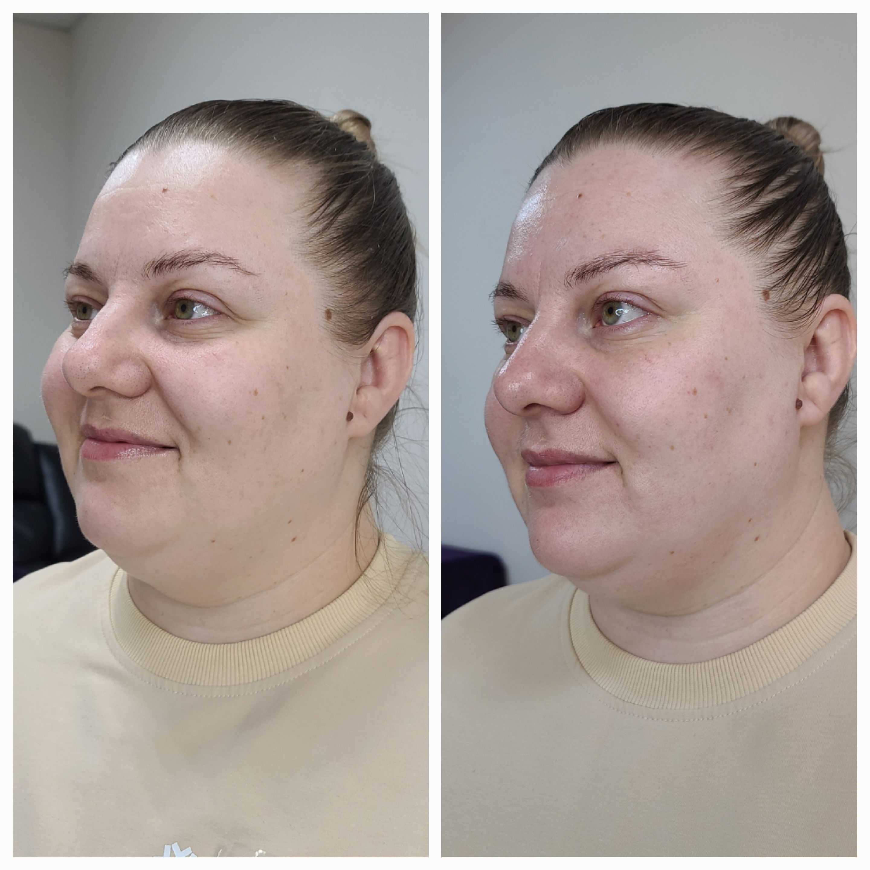 Фото услуги